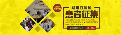 疑難白癜風(fēng)患者征集項(xiàng)目