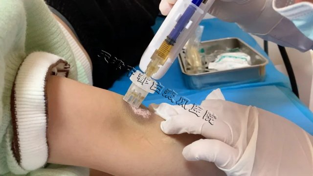 天津白癜風(fēng)醫(yī)院