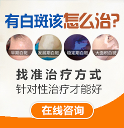 天津白癜風治療要多少錢？